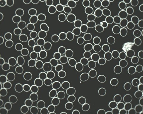 rode bloedcellen en een witte bloedcel onder een donkerveldmicroscoop bekeken